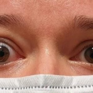 L’hypothyroïdie et la vue