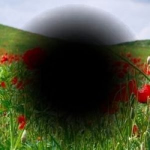 Dégénérescence Maculaire Liée à l’Âge (DMLA) : Synthèse pour les professionnels de santé